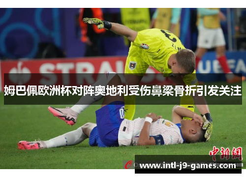 姆巴佩欧洲杯对阵奥地利受伤鼻梁骨折引发关注
